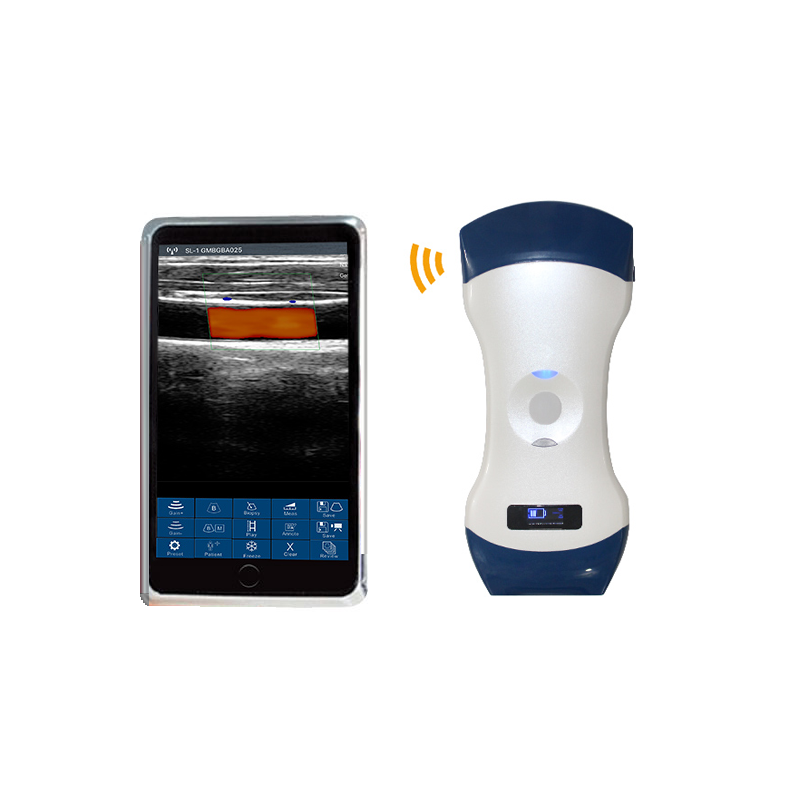 2in1 color doppler palm ultrasound medroce 2in1 color doppler palm ultrasound