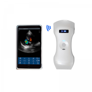 3in1 Wireless Handheld Ultrasound Scanner – Triple-Head Color Doppler Probe