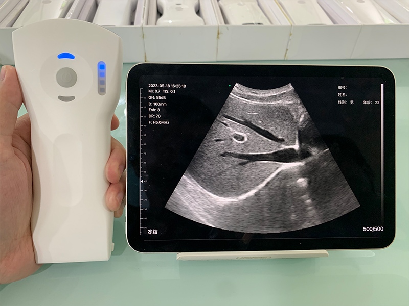 3in1 palm doppler ultrasound014