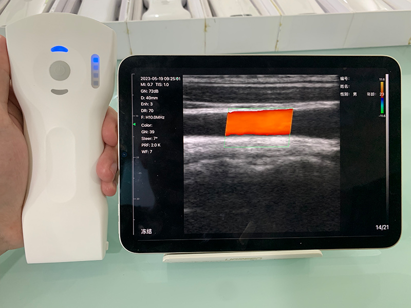 3in1 palm doppler ultrasound017