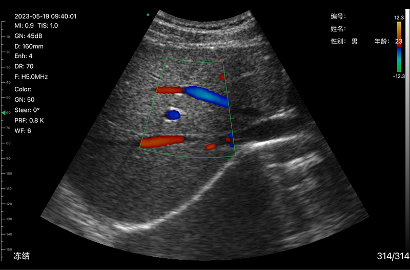3in1 palm doppler ultrasound018