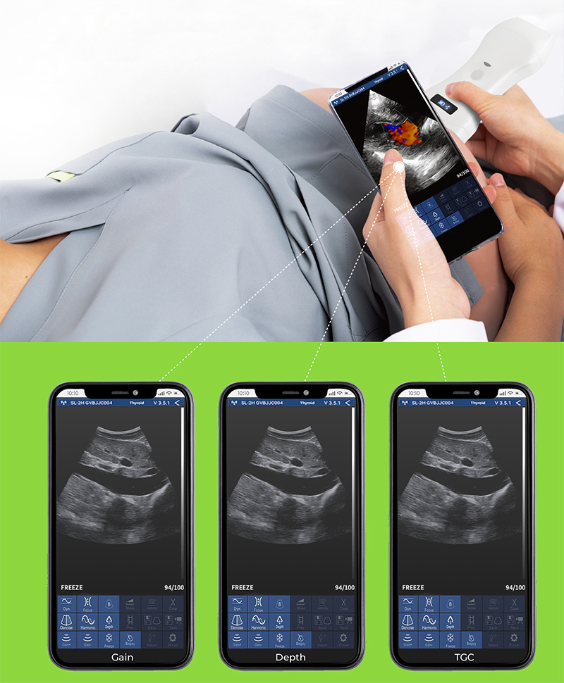 3in1 palm doppler ultrasound8 medroce 3in1 palm doppler ultrasound8