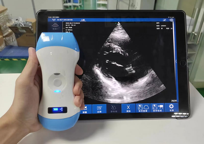 Portable 3 in 1 color doppler ultrasound convex linear phased array probe7