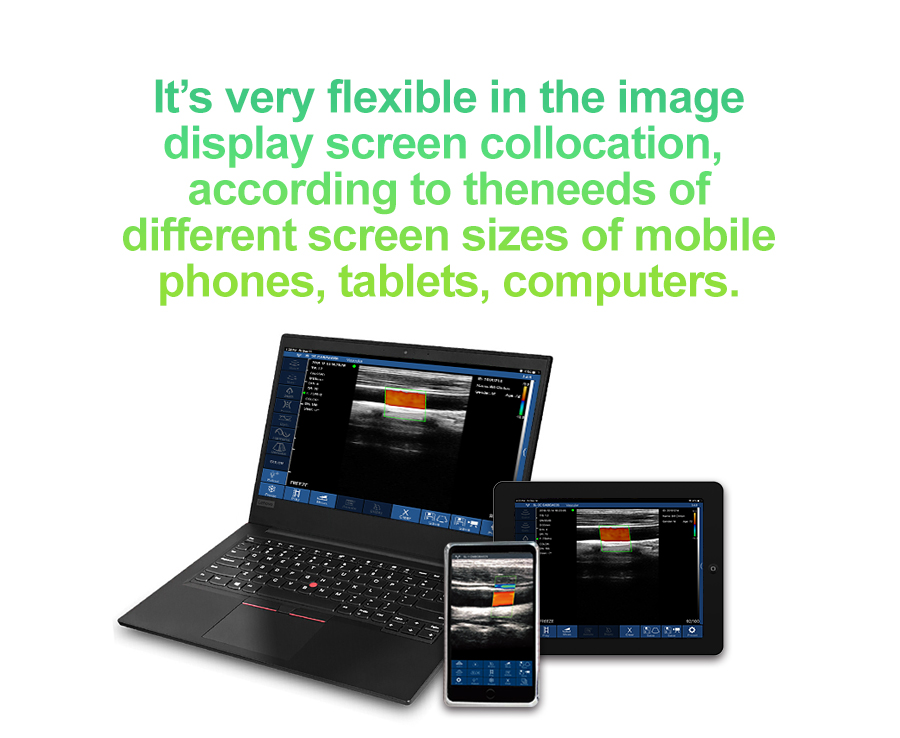 Portable 3 in 1 color doppler ultrasound convex linear phased array probe9