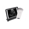 Convex palm bw ultrasound m3c portable ultrasound