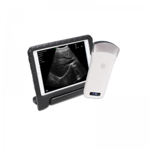 convex palm portable black & white ultrasound