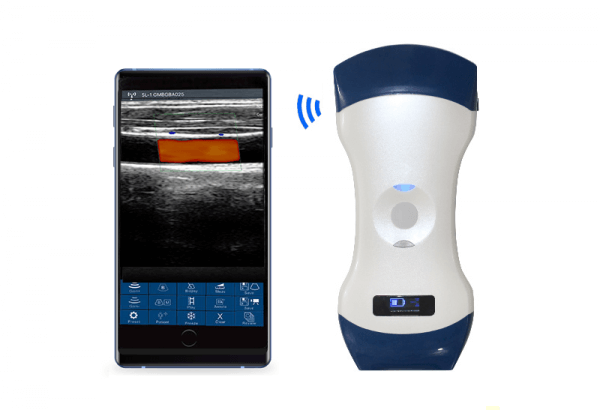2in1 palm doppler ultrasound 5mcl pocket ultrasound