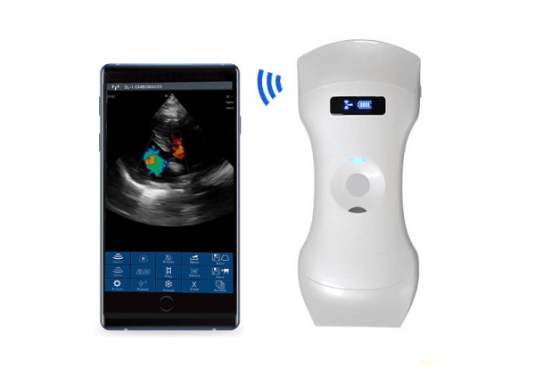 3in1 palm doppler 6mcpl pocket ultrasound