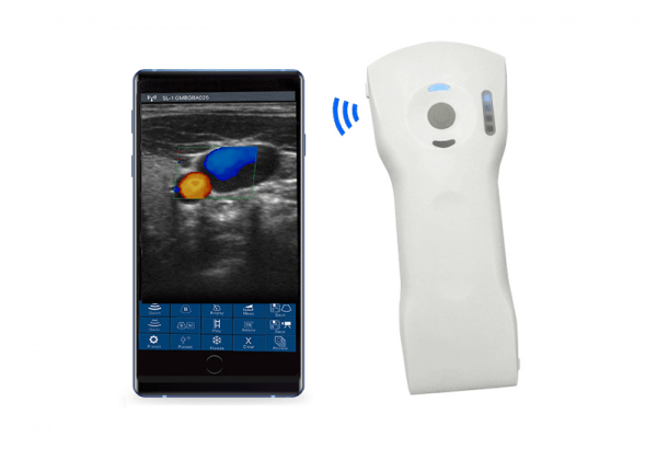 3in1 palm doppler 8mcpl pocket ultrasound