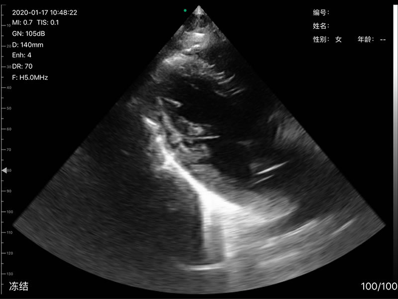3in1 palm doppler ultrasound 10