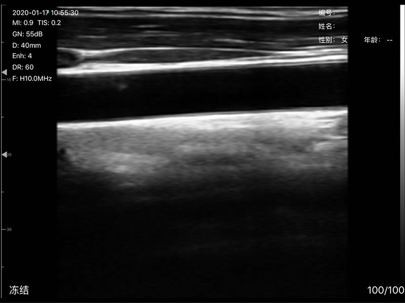 3in1 palm doppler ultrasound 11