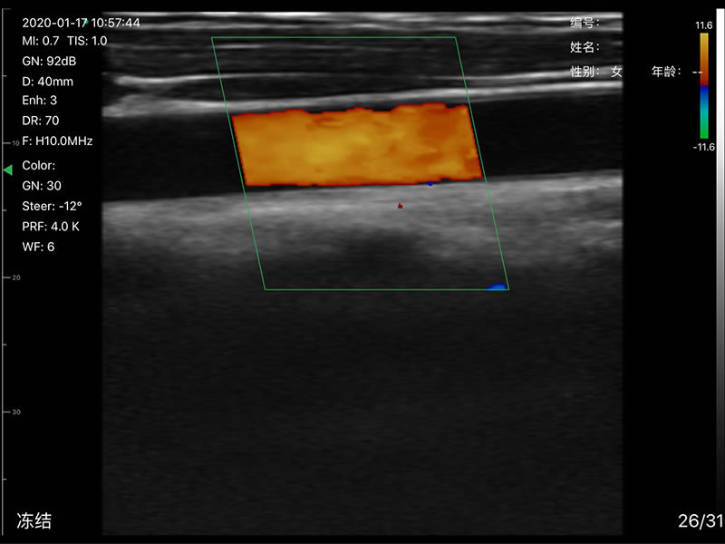 3in1 palm doppler ultrasound 12