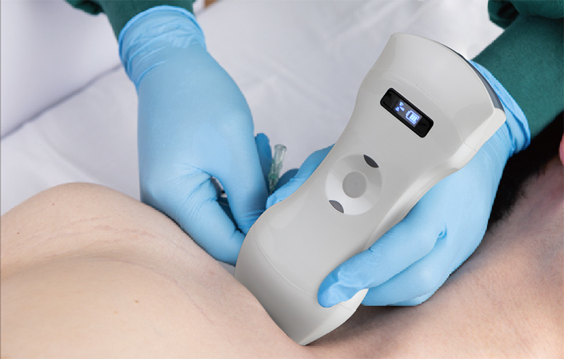 3in1 palm doppler ultrasound 14