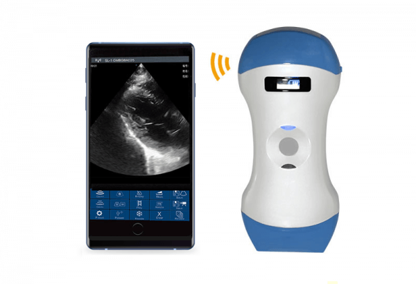 3in1 palm doppler ultrasound 5mcpl portable ultrasound