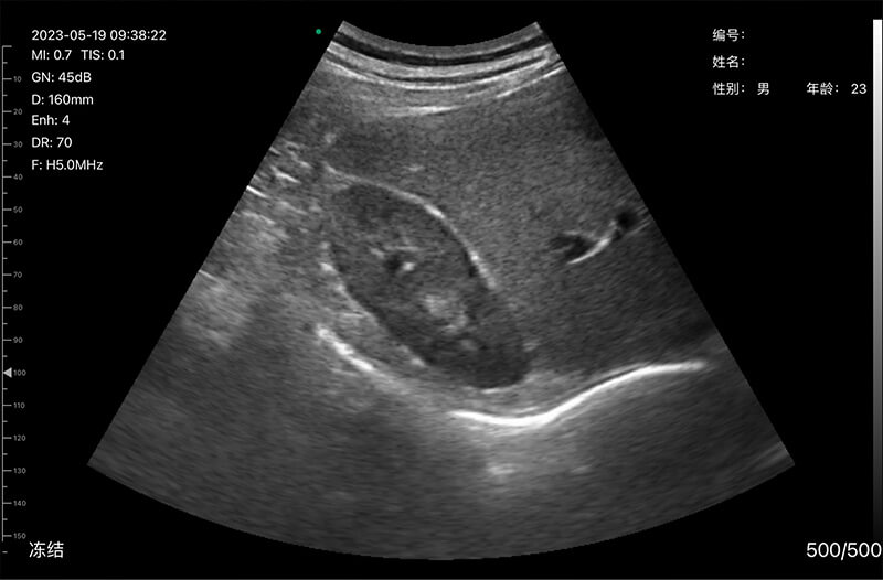 Black and white ultrasound image sample
