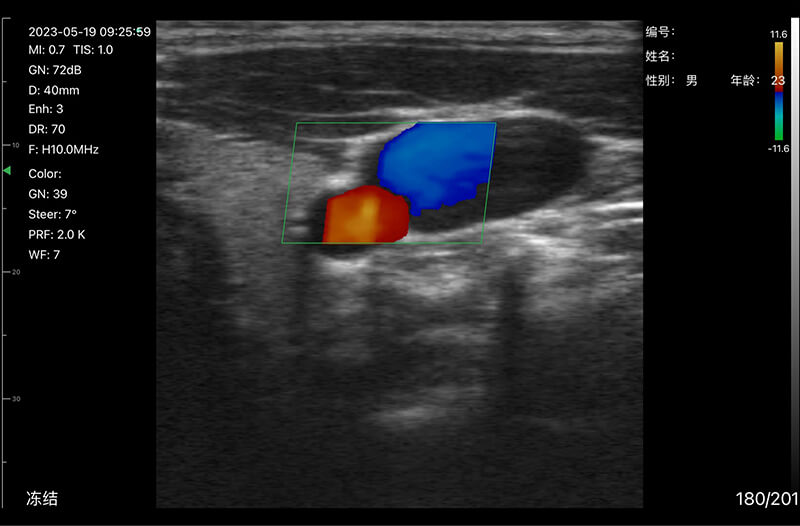 Color ultrasound image sample