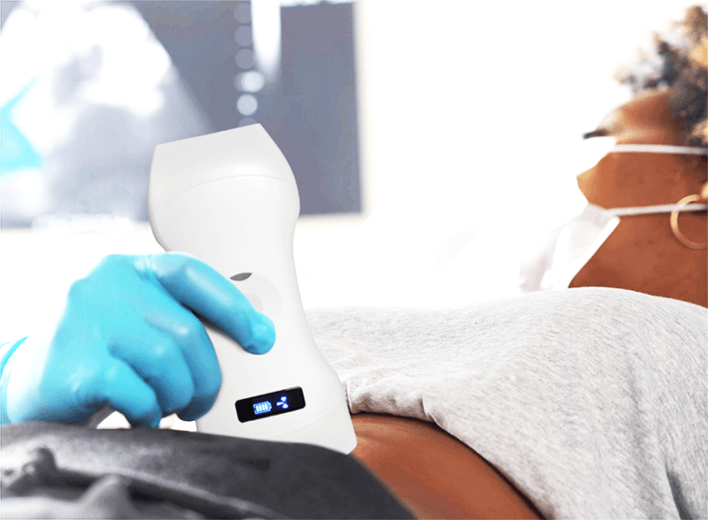 Partner with us and shape the future of ultrasound diagnostics oem pocket ultrasounds