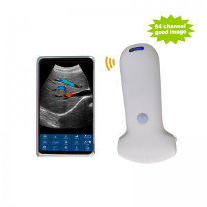Wireless Convex Probe Ultrasound Scanner | 64 Channels | High-Performance Handheld Device