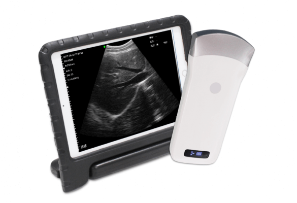 Convex palm bw ultrasound m3c portable ultrasound