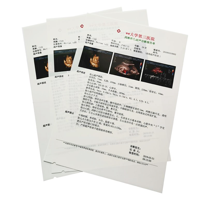 A4 White Dry Laser DICOM Film for Medical Imaging