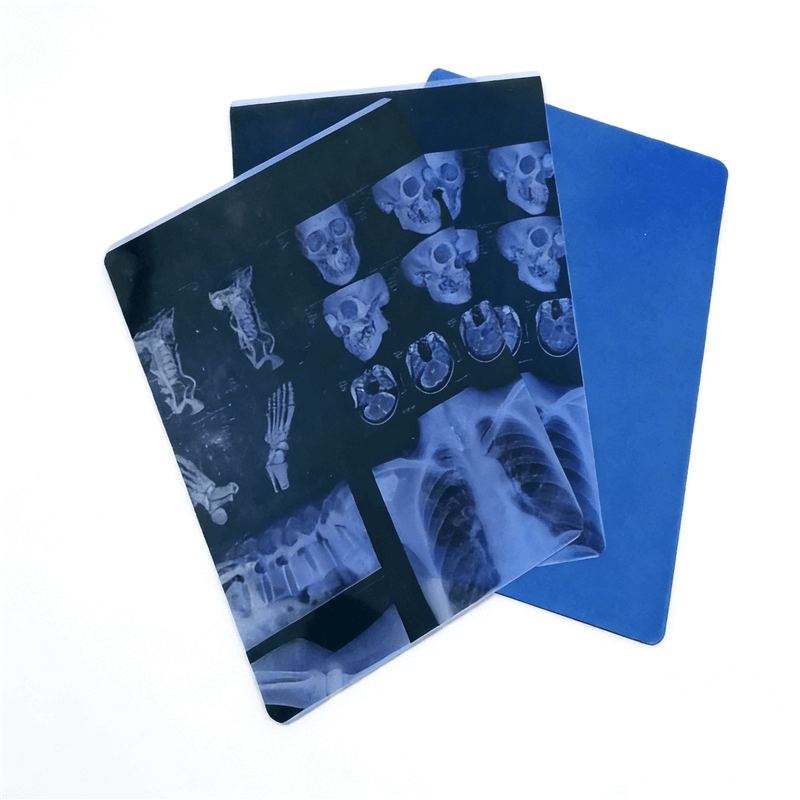 Dry laser xray film pet blue base 175micron 2 medroce Dry laser xray film pet blue base 175micron 2
